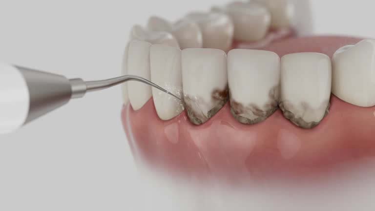 Trusted Tooth Extraction service in Lincoln, ID - Dentist Open Now
